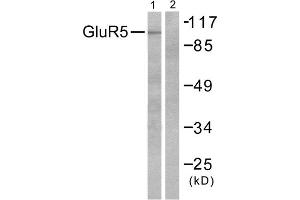 Western blot analysis of extracts from mouse brain, using GluR5 antibody (ABIN5976412).