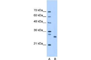 WB Suggested Anti-PSMC3IP Antibody Titration:  1.