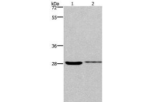 Western Blot analysis of 231 and Hela cell using CDK1 Polyclonal Antibody at dilution of 1:300 (CDK1 Antikörper)
