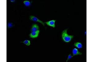 Immunofluorescence staining of MCF-7 cells with ABIN7161807 at 1:133, counter-stained with DAPI. (NUMA1 Antikörper  (AA 627-870))