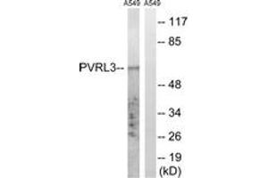 Western blot analysis of extracts from A549 cells, using PVRL3 Antibody. (nectin-3 Antikörper  (AA 184-233))