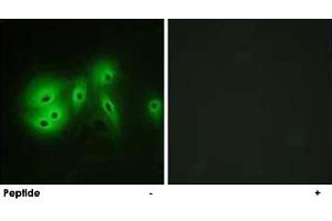 Immunofluorescence analysis of A-549 cells, using ADCY8 polyclonal antibody . (ADCY8 Antikörper)