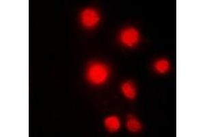 Immunofluorescent analysis of HMGB2 staining in Hela cells. (HMGB2 Antikörper)