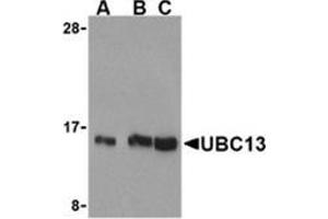 Western blot analysis of UBC13 in human small intestine cell lysates with this product at (A) 0.