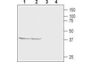 Western blot analysis of rat (lanes 1 and 3) and mouse (lanes 2 and 4) brain membranes: - 1,2. (CABP1 Antikörper  (C-Term, Intracellular))
