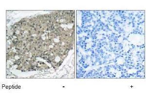 Image no. 1 for anti-V-Akt Murine Thymoma Viral Oncogene Homolog 1 (AKT1) (Thr308) antibody (ABIN197195) (AKT1 Antikörper  (Thr308))