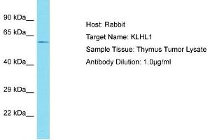 Host: Rabbit Target Name: KLHL1 Sample Tissue: Human Thymus Tumor Antibody Dilution: 1ug/ml (KLHL1 Antikörper  (C-Term))