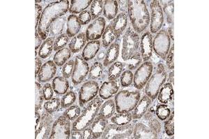 Immunohistochemical staining of human kidney with SLC7A4 polyclonal antibody  shows distinct cytoplasmic positivity with a granular pattern in tubular cells.