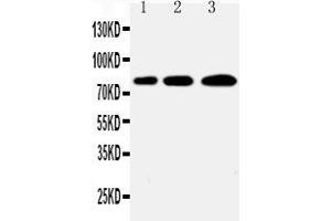 Western blot analysis of PLK2/Snk using anti- PLK2/Snk antibody .