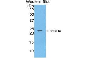 Detection of Recombinant NME3, Human using Polyclonal Antibody to Non Metastatic Cells 3, Protein NM23A Expressed In (NME3) (NME3 Antikörper  (AA 1-168))
