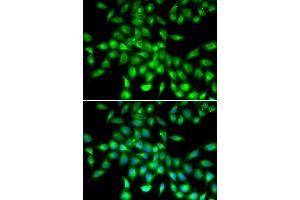 anti-serpin Peptidase Inhibitor, Clade A (Alpha-1 Antiproteinase, Antitrypsin), Member 10 (SERPINA10) (AA 165-444) antibody