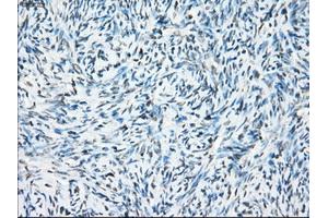Immunohistochemical staining of paraffin-embedded colon tissue using anti-CRYABmouse monoclonal antibody. (CRYAB Antikörper)