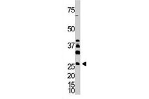 The DKK4 polyclonal antibody  is used in Western blot to detect DKK4 in A-375 cell lysate. (DKK4 Antikörper  (AA 162-189))