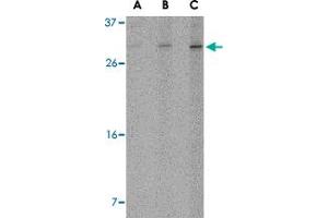 Western blot analysis of ORAI2 in Jurkat cell lysate with ORAI2 polyclonal antibody  at (A) 1, (B) 2 and (C) 4 ug/mL . (ORAI2 Antikörper  (C-Term))