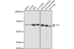 Western blot analysis of extracts of various cell lines, using YY1 antibody (ABIN6128933, ABIN6150354, ABIN6150356 and ABIN6216742) at 1:1000 dilution. (YY1 Antikörper  (AA 1-200))