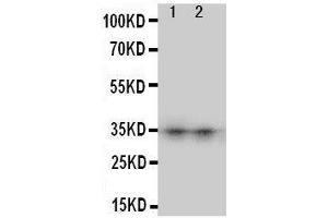 Anti-Aquaporin 8 antibody, Western blotting Lane 1: SW620 Cell Lysate Lane 2: COLO320 Cell Lysate (Aquaporin 8 Antikörper  (N-Term))