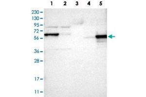 Western Blot analysis of Lane 1: RT-4 cell, Lane 2: U-251 MG sp cell, Lane 3: human plasma tissue (IgG/HSA depleted), Lane 4: human liver tissue and Lane 5: human tonsil tissue lysates with ICA1 polyclonal antibody . (ICA1 Antikörper)