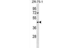 Western Blotting (WB) image for anti-Olfactory Receptor, Family 2, Subfamily T, Member 6 (OR2T6) antibody (ABIN2998458) (OR2T6 Antikörper)
