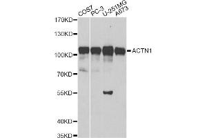 Western blot analysis of extracts of various cell lines, using ACTN1 antibody. (ACTN1 Antikörper)