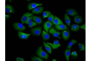 Immunofluorescence staining of A549 cells with ABIN7168014 at 1:66, counter-stained with DAPI. (RND1 Antikörper  (AA 1-106))
