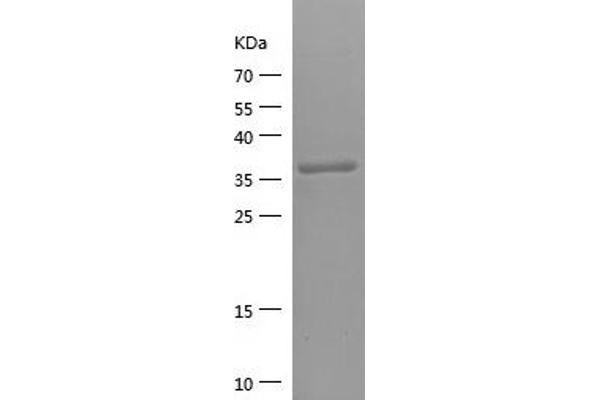 SLC1A2 Protein (AA 143-240) (His-IF2DI Tag)