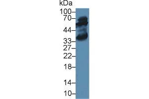 Western blot analysis of Rat Liver lysate, using Rabbit Anti-Human ALT Antibody (2 µg/ml) and HRP-conjugated Goat Anti-Rabbit antibody (abx400043, 0. (ALT Antikörper  (AA 147-263))