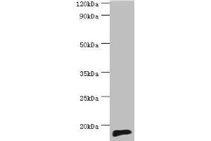 Western blot All lanes: TNNC2 antibody at 10 μg/mL + Mouse skeletal muscle tissue Secondary Goat polyclonal to rabbit IgG at 1/10000 dilution Predicted band size: 18 kDa Observed band size: 18 kDa (TNNC2 Antikörper  (AA 1-160))