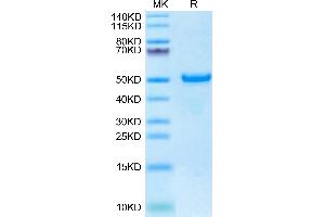 Biotinylated Human DKK1 C terminal Domain on Tris-Bis PAGE under reduced condition. (DKK1 Protein (C-Term) (Fc-Avi Tag,Biotin))