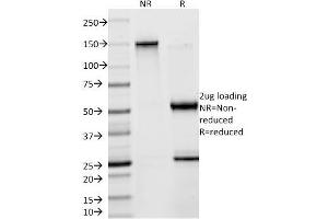 SDS-PAGE Analysis Purified Creatine Kinase-BB (CKBB) Mouse Monoclonal Antibody (2ba6). (CKB Antikörper)