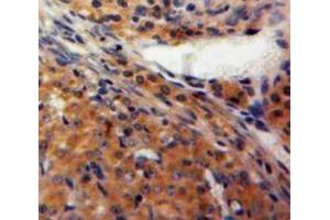 IHC-P analysis of Ovary tissue, with DAB staining. (FBLN2 Antikörper  (AA 858-1069))