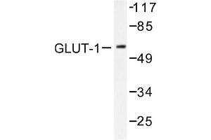Image no. 1 for anti-Solute Carrier Family 2 (Facilitated Glucose Transporter), Member 1 (SLC2A1) antibody (ABIN265442) (GLUT1 Antikörper)
