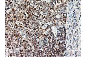 Image no. 2 for anti-Calpain 9 (CAPN9) antibody (ABIN1497092) (Calpain 9 Antikörper)