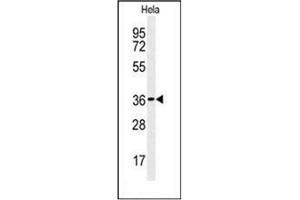 Western blot analysis of CTDSPL Antibody (N-term) in Hela cell line lysates (35ug/lane).