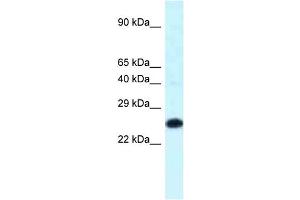 WB Suggested Anti-Hoxb9 Antibody Titration: 1. (HOXB9 Antikörper  (C-Term))
