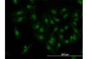 Immunofluorescence of monoclonal antibody to CDK6 on HeLa cell.