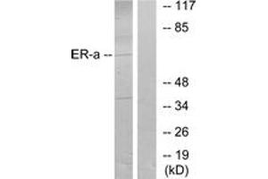 Western blot analysis of extracts from MCF7 cells, treated with Estradiol, using Estrogen Receptor-alpha (Ab-106) Antibody. (Estrogen Receptor alpha Antikörper  (AA 71-120))