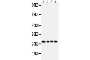 Anti-FGF22 antibody, Western blotting Lane 1: Rat Ovary Tissue Lysate Lane 2: Rat Ovary Tissue Lysate Lane 3: Rat Testis Tissue Lysate Lane 4: Rat Testis Tissue Lysate (FGF22 Antikörper  (Middle Region))
