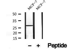Western blot analysis of extracts of MCF-7 cells, using Phospho-MFF (Ser172) Antibody.