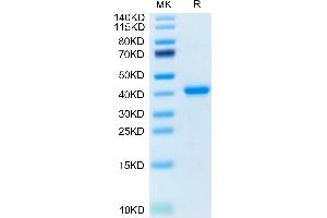 Human TNFRSF12A on Tris-Bis PAGE under reduced condition. (TNFRSF12A Protein (AA 28-80) (Fc Tag))