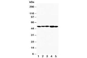 Western blot testing of TIM-1 antibody and Lane 1:  SMMC-7721 (HAVCR1 Antikörper  (AA 289-307))
