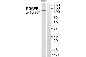 Western blot analysis of extracts from HepG2 cells, using PDGFRb (Phospho-Tyr771) antibody. (ARFGAP3 Antikörper  (Internal Region))