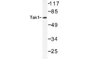 Image no. 1 for anti-Mitogen-Activated Protein Kinase Kinase Kinase 7 (MAP3K7) antibody (ABIN272124) (MAP3K7 Antikörper)