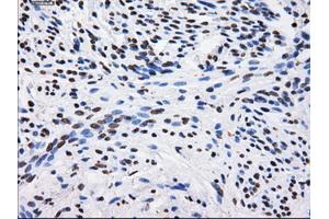Immunohistochemical staining of paraffin-embedded Kidney tissue using anti-BTN3A2 mouse monoclonal antibody.