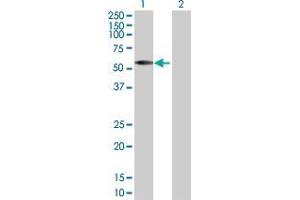 Lane 1: IRX2 transfected lysate ( 51. (IRX2 293T Cell Transient Overexpression Lysate(Denatured))