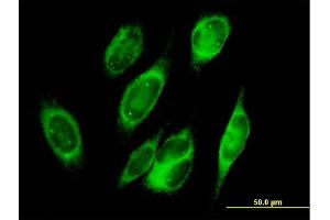 Immunofluorescence of purified MaxPab antibody to PRDX4 on HeLa cell. (Peroxiredoxin 4 Antikörper  (AA 1-271))
