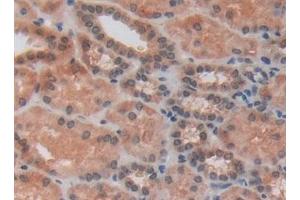 Immunohistochemistry (IHC) image for anti-R-Spondin 1 (RSPO1) (AA 21-135) antibody (ABIN7430144)
