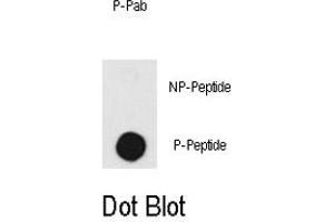 Dot blot analysis of PRKDC (phospho T2609) polyclonal antibody  on nitrocellulose membrane. (PRKDC Antikörper  (pThr2609))