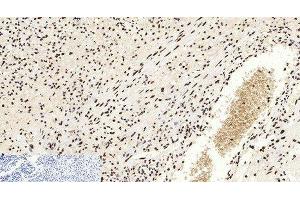 Immunohistochemistry of paraffin-embedded Human appendix tissue using Acetyl-Histone H3 (Lys9) Polyclonal Antibody at dilution of 1:200. (Histone 3 Antikörper  (acLys9))