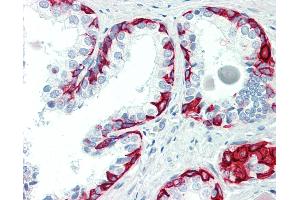 Immunohistochemistry (IHC) image for anti-Activin A Receptor, Type IIB (ACVR2B) (AA 287-336) antibody (ABIN2614264)