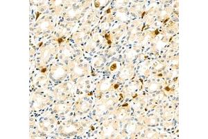 Immunohistochemistry of paraffin embedded human stomach using CD307 (ABIN7073931) at dilution of 1:1000 (300x lens)